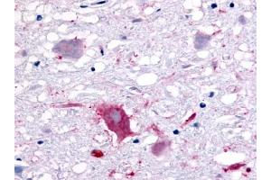 Immunohistochemical staining of Brain (Neurons and glia) using anti- GPR32 antibody ABIN122142