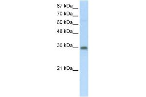 SFRS10 antibody used at 5 ug/ml to detect target protein. (TRA2B antibody)