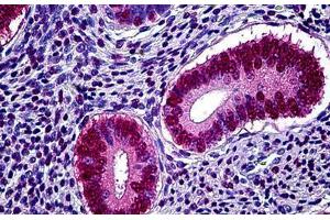 Human Uterus: Formalin-Fixed, Paraffin-Embedded (FFPE) (Progesterone Receptor antibody)