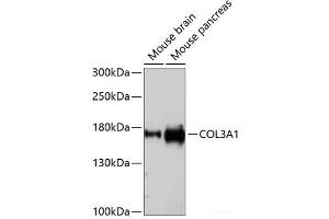 Western blot analysis of extracts of various cell lines using COL3A1 Polyclonal Antibody at dilution of 1:1000.