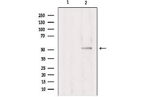 Western blot analysis of extracts from Hepg2, using TRIM38 Antibody. (TRIM38 antibody  (Internal Region))