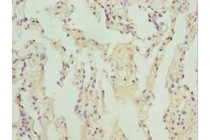 Immunohistochemistry of paraffin-embedded human lung tissue using ABIN7171726 at dilution of 1:100 (ZBTB48 antibody  (AA 1-280))