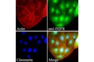 Image no. 2 for anti-Epidermal Growth Factor Receptor (EGFR) (AA 424-605) antibody (ABIN782452)