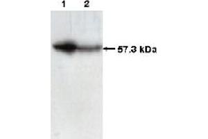 Western Blotting (WB) image for anti-Chaperonin Containing TCP1, Subunit 2 (Beta) (CCT2) (C-Term) antibody (ABIN264513) (CCT2 antibody  (C-Term))