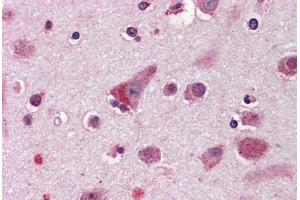 Anti-ELOVL5 antibody  ABIN960769 IHC staining of human brain, cortex. (ELOVL5 antibody  (Internal Region))