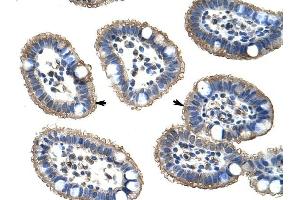 NUDT21 antibody was used for immunohistochemistry at a concentration of 4-8 ug/ml to stain Epithelial cells of intestinal villus (arrows) in Human Intestine.