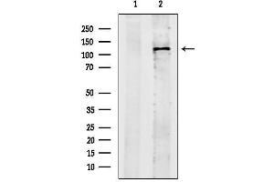 anti-Diaphanous Homolog 3 (Drosophila) (DIAPH3) (Internal Region) antibody