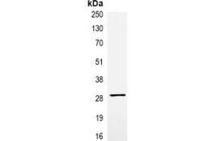 Immunoprecipitation of VSV-G-tagged protein from HEK293T cells transfected with vector overexpressing VSV-G tag, using Anti-VSV-G-tag Antibody. (VSV-g Tag antibody)