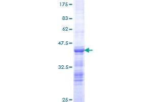 PDS5B Protein (AA 1168-1259) (GST tag)