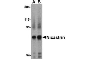 Western Blotting (WB) image for anti-Nicastrin (NCSTN) (Middle Region) antibody (ABIN1031014)
