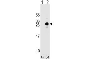 Western Blotting (WB) image for anti-Sclerostin (SOST) antibody (ABIN2912280)