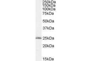 Western Blotting (WB) image for anti-SAR1 Homolog B (SAR1B) (AA 104-116) antibody (ABIN292166) (SAR1B antibody  (AA 104-116))