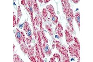 IHC analysis of FFPE human heart tissue stained with Aconitase 2 antibody.