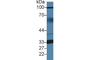 Detection of ZBP1 in Human Serum using Polyclonal Antibody to Z-DNA Binding Protein 1 (ZBP1) (ZBP1 antibody  (AA 10-167))