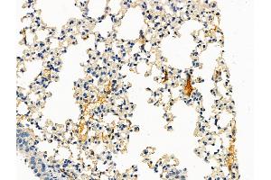 ABIN7093259 and ABIN7097276 at 1/100 staining Mouse lung tissue by IHC-P.