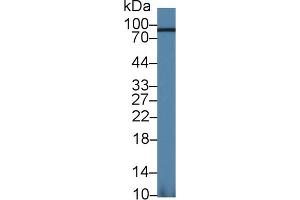 Western Blot; Sample: Mouse Kidney lysate; Primary Ab: 1. (Aconitase 1 antibody  (AA 527-719))