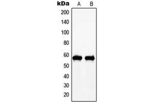 Western blot analysis of c-Myc (pT58) expression in A431 (A), HeLa (B) whole cell lysates.
