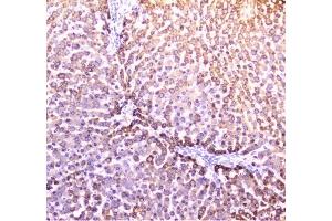 IHC analysis of PON1 using anti-PON1 antibody (ABIN6719356). (PON1 antibody  (AA 30-274))