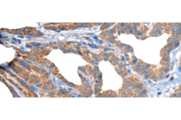 RTN4IP1 antibody