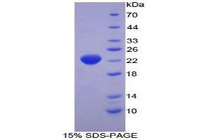 SDS-PAGE analysis of Human Interferon alpha 2 Protein. (IFNA2 Protein)
