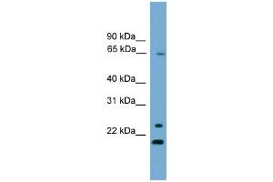 WB Suggested Anti-ZNF37A Antibody Titration:  0. (ZNF37A antibody  (Middle Region))