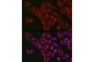 Immunofluorescence analysis of U2OS cells using NQO1 Rabbit pAb (ABIN1681096, ABIN3015018, ABIN3015019 and ABIN6213595) at dilution of 1:50 (40x lens). (NQO1 antibody  (AA 1-274))