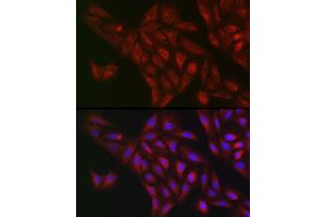 Immunofluorescence analysis of U2OS cells using NQO1 Rabbit pAb (ABIN1681096, ABIN3015018, ABIN3015019 and ABIN6213595) at dilution of 1:50 (40x lens). (NQO1 antibody  (AA 1-274))