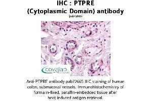 Image no. 1 for anti-Protein tyrosine Phosphatase, Receptor Type, E (PTPRE) (Cytoplasmic Domain) antibody (ABIN1738608) (PTPRE antibody  (Cytoplasmic Domain))