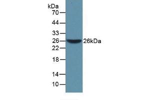 Detection of Recombinant WARS, Mouse using Polyclonal Antibody to Tryptophanyl tRNA Synthetase (WARS) (WARS antibody  (AA 29-195))