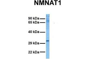 Host:  Rabbit  Target Name:  NMNAT1  Sample Tissue:  Human HCT116  Antibody Dilution:  1. (NMNAT1 antibody  (N-Term))