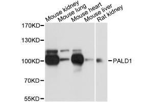 Western blot analysis of extracts of various cell lines, using PALD1 antibody. (KIAA1274 antibody)