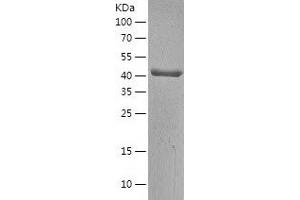 Western Blotting (WB) image for Branched Chain Keto Acid Dehydrogenase E1, alpha Polypeptide (BCKDHA) (AA 46-445) protein (His tag) (ABIN7285346) (BCKDHA Protein (AA 46-445) (His tag))