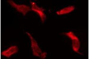 ABIN6274674 staining HeLa by IF/ICC. (IL20RB antibody  (Internal Region))