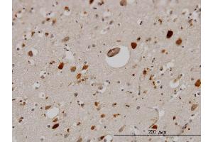 Immunoperoxidase of monoclonal antibody to PTN on formalin-fixed paraffin-embedded human cerebral cortex. (Pleiotrophin antibody  (AA 45-154))