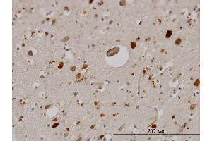 Immunoperoxidase of monoclonal antibody to PTN on formalin-fixed paraffin-embedded human cerebral cortex. (Pleiotrophin antibody  (AA 45-154))