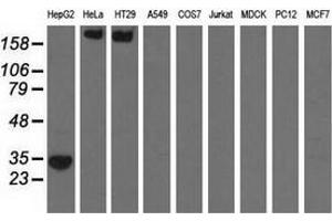Western blot analysis of extracts (35 µg) from 9 different cell lines by using anti-SULT2A1 monoclonal antibody. (SULT2A1 antibody)