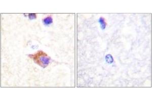 Immunohistochemistry analysis of paraffin-embedded human brain, using PLCG2 (Phospho-Tyr1217) Antibody. (Phospholipase C gamma 2 antibody  (pTyr1217))