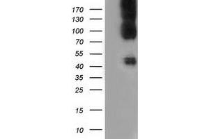 HEK293T cells were transfected with the pCMV6-ENTRY control (Left lane) or pCMV6-ENTRY CD80 (Right lane) cDNA for 48 hrs and lysed. (CD80 antibody)