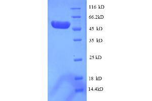 SDS-PAGE (SDS) image for PSME3 (PSME3) (AA 2-252), (partial) protein (GST tag) (ABIN5712868) (PSME3 Protein (PSME3) (AA 2-252, partial) (GST tag))