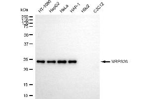 Western blotting analysis using MRPS26 antibody (ABIN7799434). (Recombinant MRPS26 antibody)