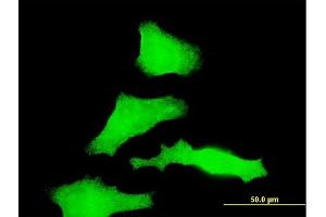 Immunofluorescence of monoclonal antibody to RAB31 on HeLa cell. (RAB31 antibody  (AA 96-195))