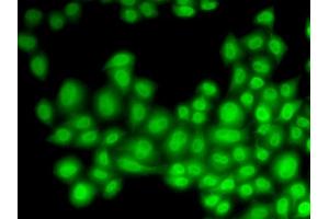 Immunofluorescence (IF) image for anti-Cullin 4B (CUL4B) antibody (ABIN1876588) (Cullin 4B antibody)