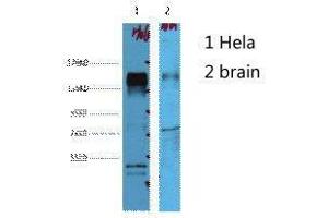 Western Blot (WB) analysis of 1) HeLa, 2) Mouse Brain, diluted at 1:4000. (ErbB2/Her2 antibody)