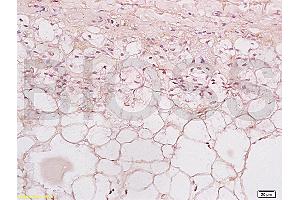 Formalin-fixed and paraffin embedded human thyroid labeled with Rabbit Anti TPO Polyclonal Antibody, Unconjugated at 1:200 followed by conjugation to the secondary antibody and DAB staining (Thyroperoxidase antibody  (AA 351-450))