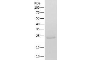 Western Blotting (WB) image for CD274 (PD-L1) (AA 19-239) protein (His-IF2DI Tag) (ABIN7122198)