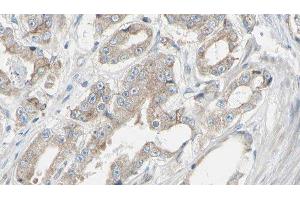 ABIN6278390 at 1/100 staining Human prostate tissue by IHC-P.