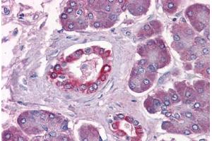 Human Pancreas: Formalin-Fixed, Paraffin-Embedded (FFPE) (DUSP6 antibody  (AA 1-382))