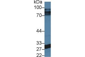 Detection of CA5A in Rat Lung lysate using Polyclonal Antibody to Carbonic Anhydrase VA (CA5A)