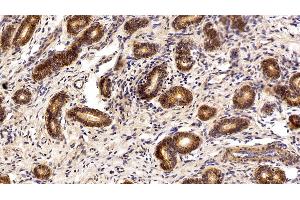 Immunohistochemistry (IHC) image for anti-Epithelial Cell Adhesion Molecule (EPCAM) (AA 25-265) antibody (ABIN7443065)