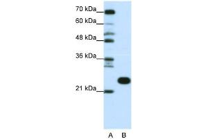 WB Suggested Anti-RPL13 Antibody Titration:  0. (RPL13 antibody  (C-Term))
